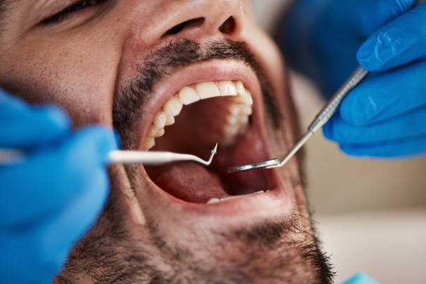 Best 24-Hour Emergency Dental Care in Lewisburg, TN